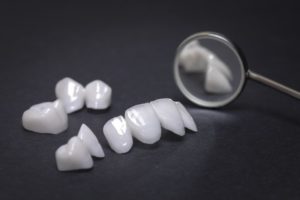 Beautifully white porcelain veneers