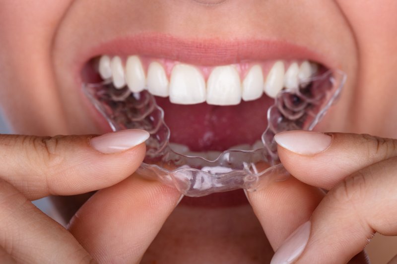 patient wearing Invisalign or ClearCorrect