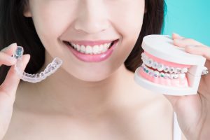 Woman holding clear aligner and model of braces