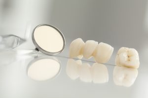 CEREC crowns are realistic and durable.